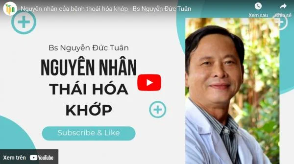 Nguyên nhân của bệnh thoái hóa khớp - Bs Nguyễn Đức Tuân