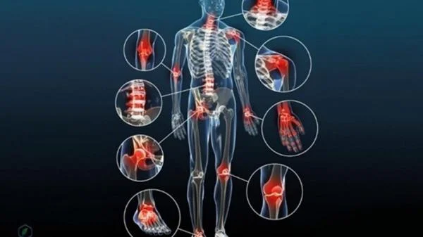 Thoái hóa khớp có giới hạn độ tuổi?