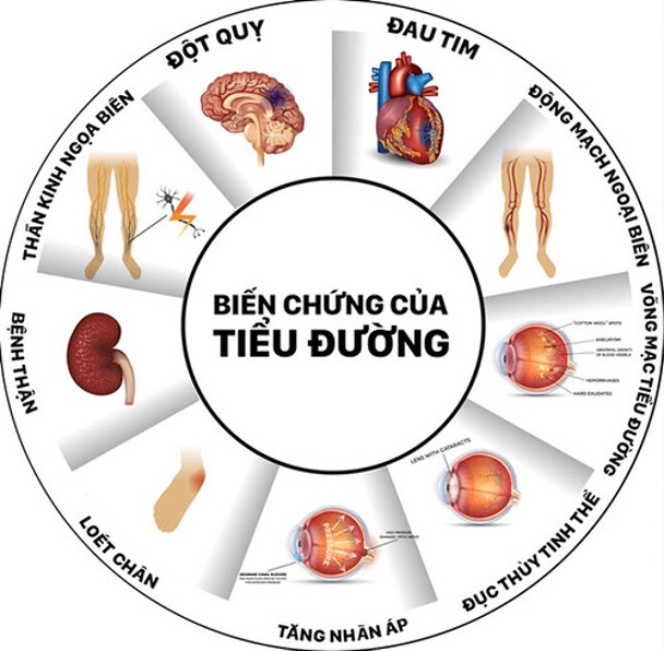 bệnh tiểu đường