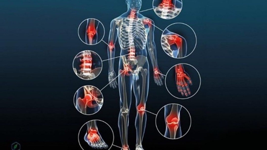 Bệnh thoái hoá khớp