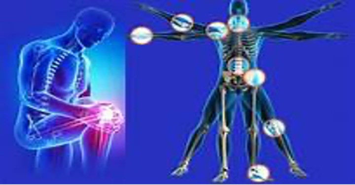 Bệnh thoái hoá khớp